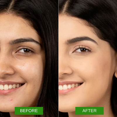 DVYNE Face Serum