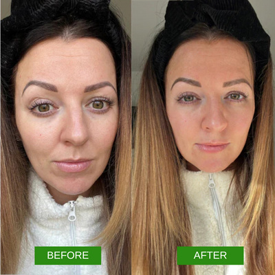 DVYNE Face Serum